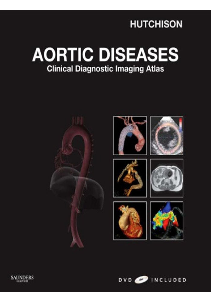 Aortic Diseases Clinical Diagnostic Imaging Atlas
