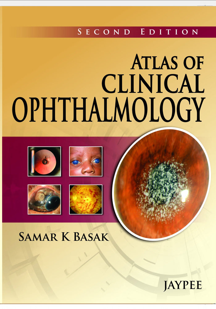 Atlas of Clinical Ophthalmology