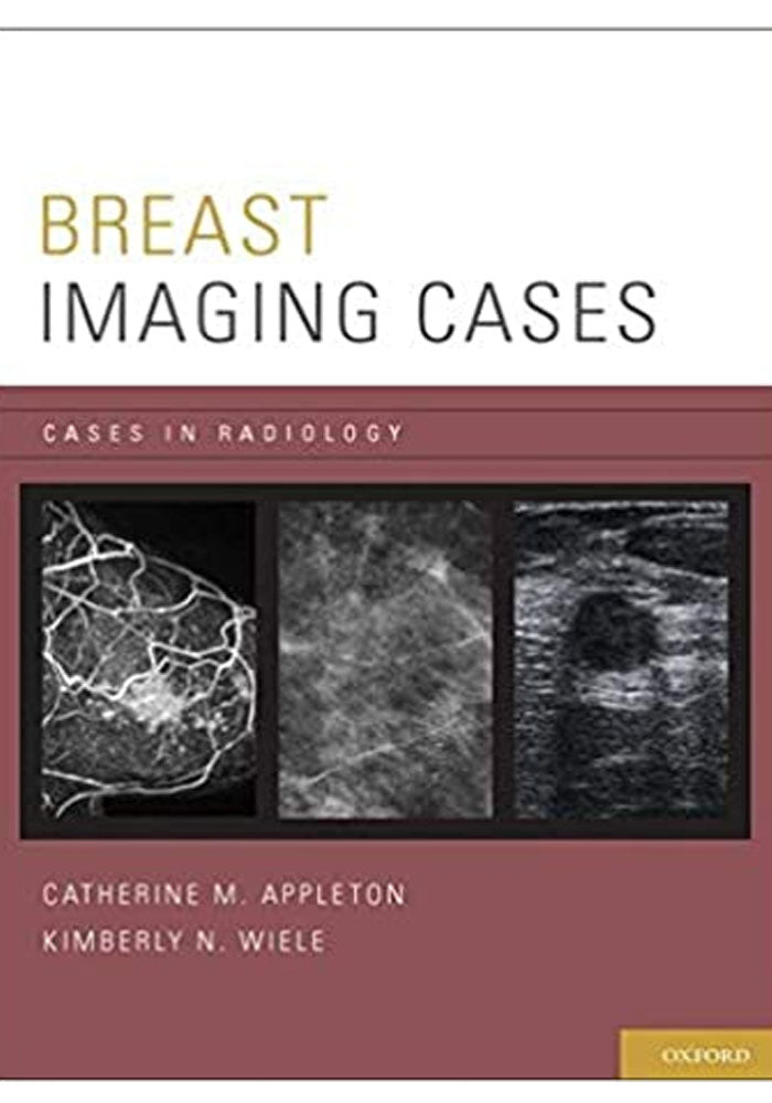 Breast Imaging Cases (Cases in Radiology) Illustrated Edition, Kindle Edition