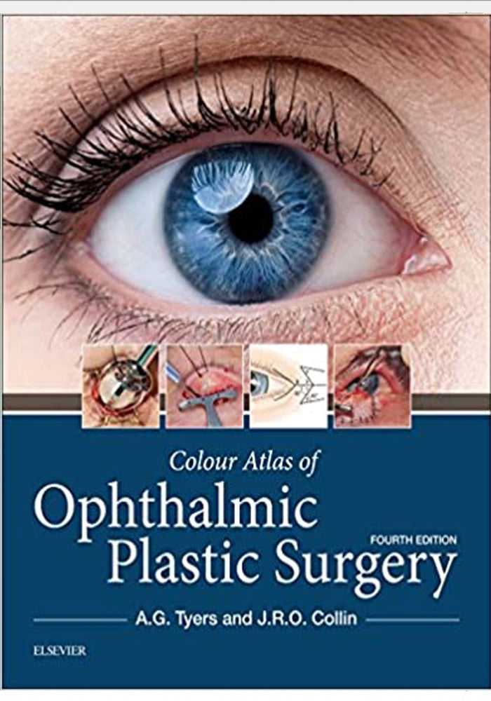 Colour Atlas of Ophthalmic Plastic Surgery 4th Ed