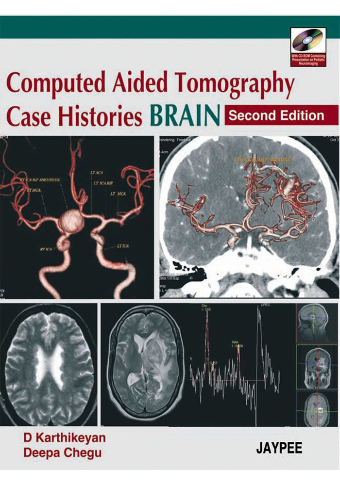 Computed Aided Tomography Case Histories BRAIN 2nd Edition