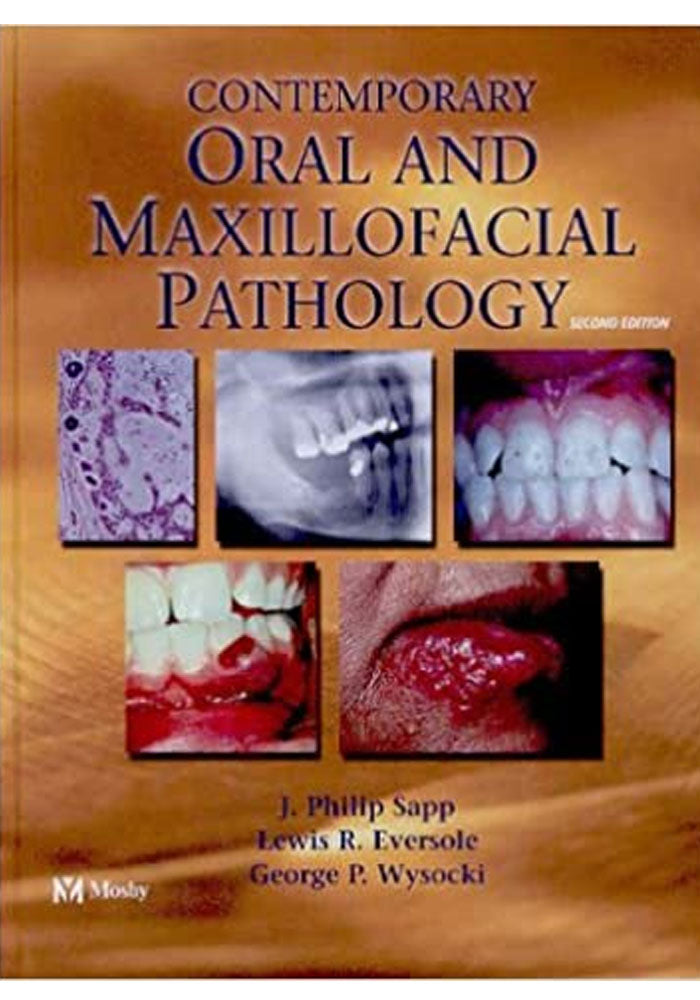 Contemporary Oral & Maxillofacial Pathology 2nd EDITION Unknown Binding