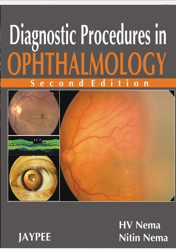 Diagnostic Procedures in Ophthalmology 2nd Edition