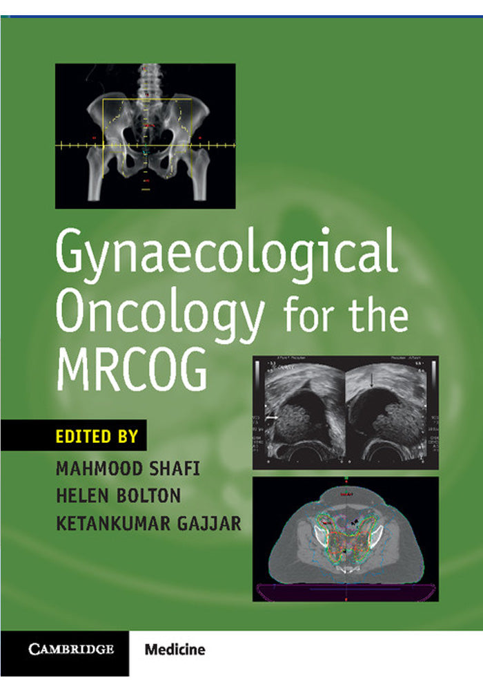 Gynaecological Oncology for the MRCOG