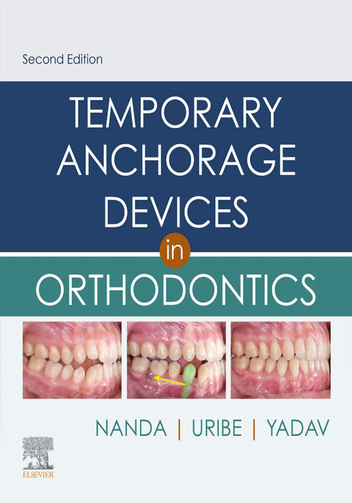 Temporary Anchorage Devices in Clinical Orthodontics