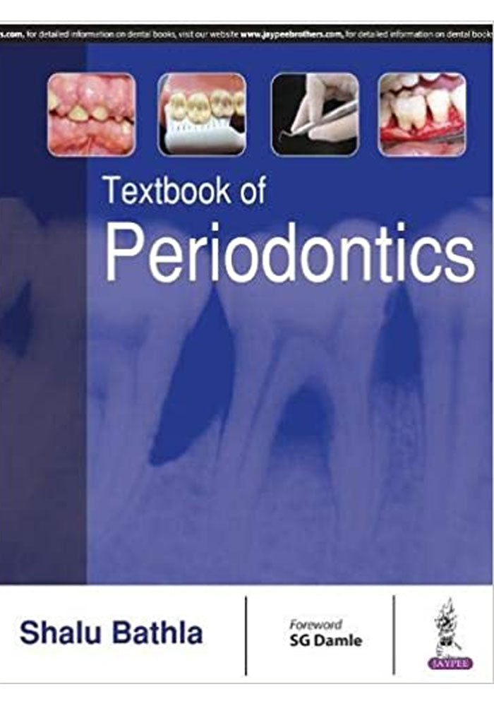 Textbook of Periodontics