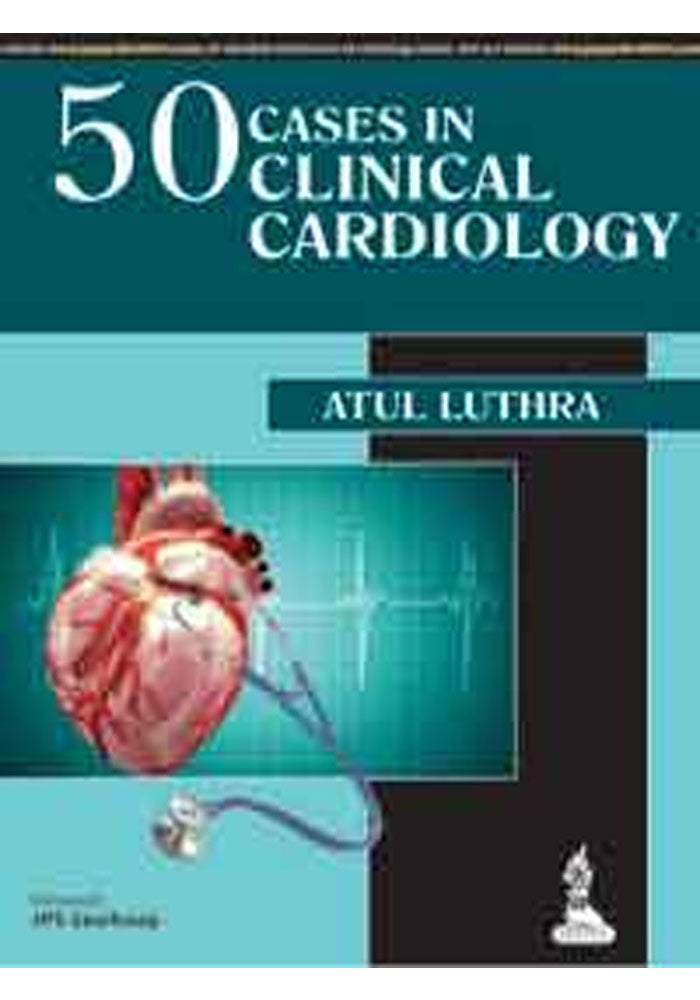 50 Cases in Clinical Cardiology