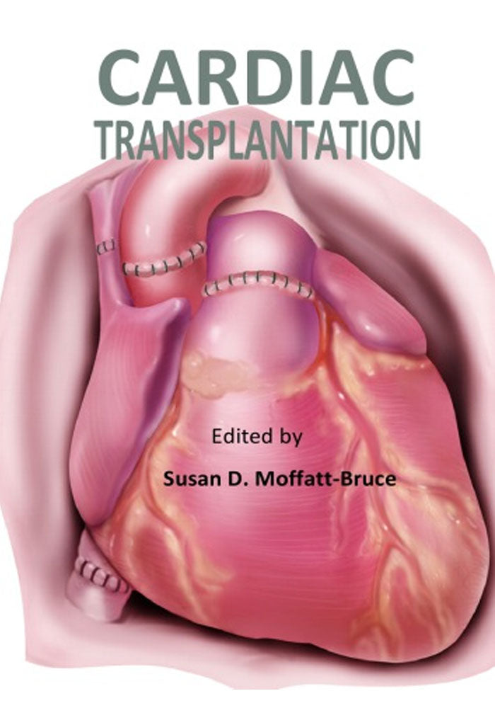 Cardiac Transplantation