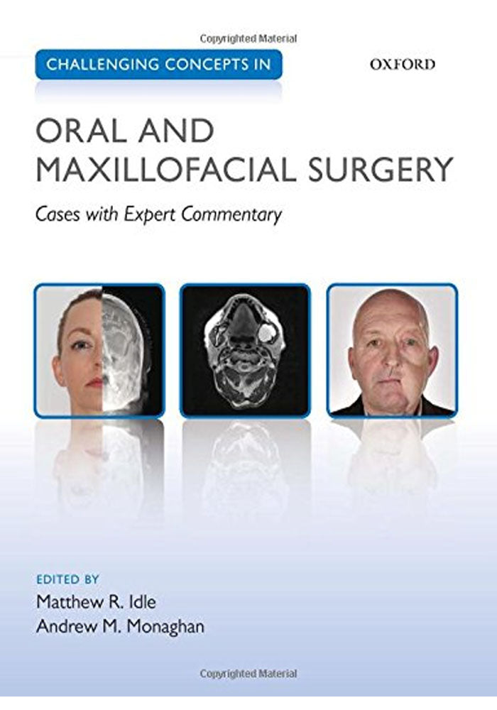 Challenging Concepts in Oral and Maxillofacial Surgery: Cases with Expert Commentary (Challenging Cases) 1st Edition, Kindle Edition