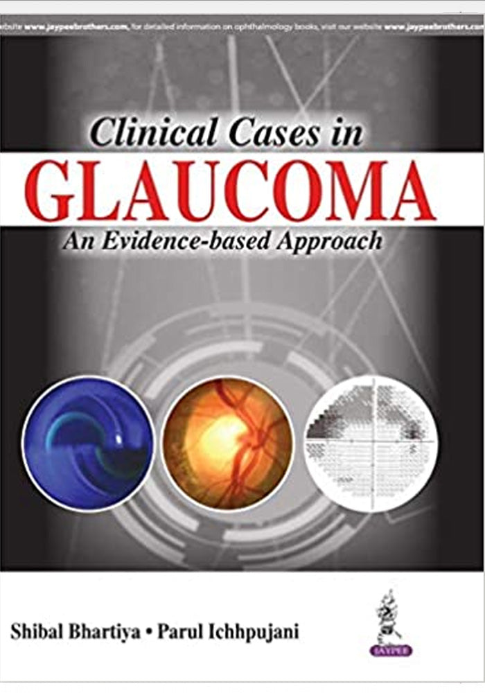 Clinical Cases in Glaucoma An Evidence Based Approach