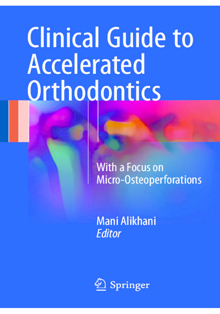 Clinical Guide to Accelerated Orthodontics With a Focus on Micro Osteoperforations