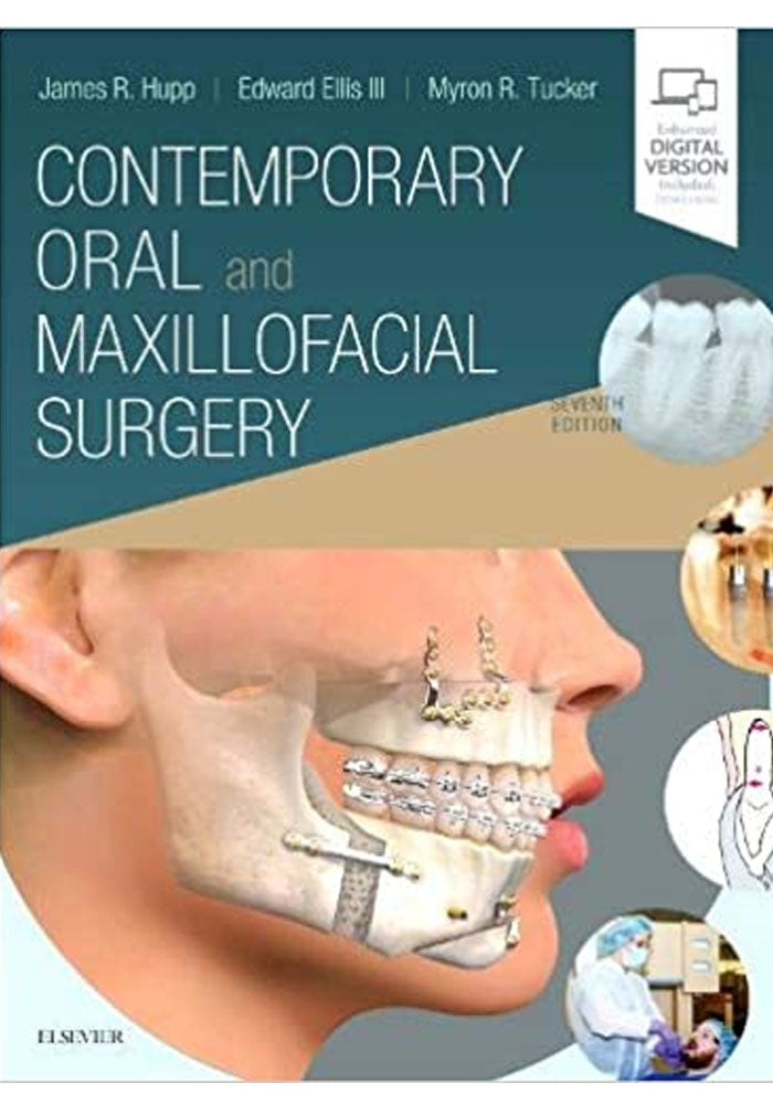 Maxilo Facial Book Contemporary Oral and Maxillofacial Surgery 7th Edition – Book A Book ...