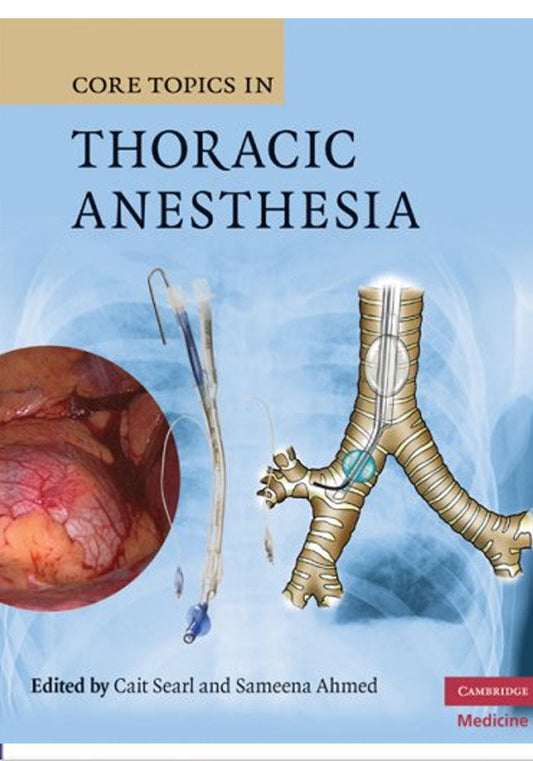 Core Topics in Thoracic Anesthesia 1st Edition, Kindle Edition