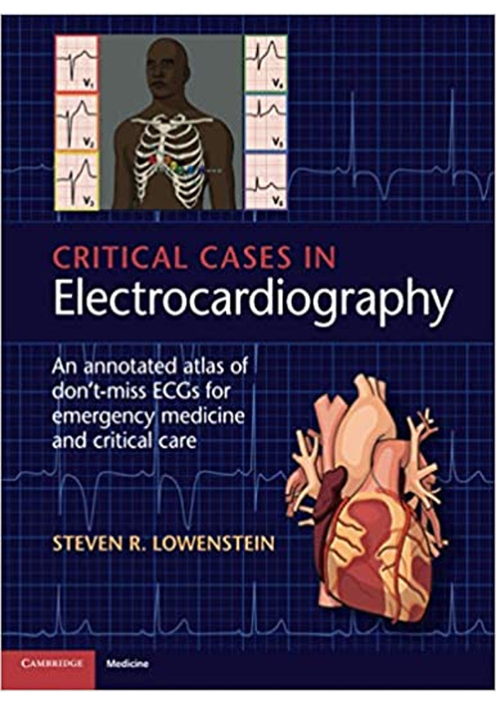 Critical Cases in Electrocardiography An Annotated Atlas of Dont Miss ECGs for Emergency Medicine and Critical Care