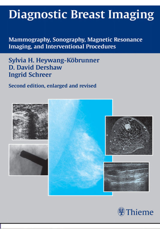 Diagnostic Breast Imaging: Mammography, Sonography, Magnetic Resonance Imaging, and Interventional Procedures 3rd Edition, Kindle Edition