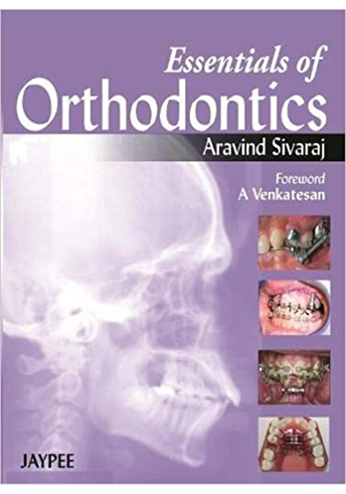 Essentials of Orthodontics