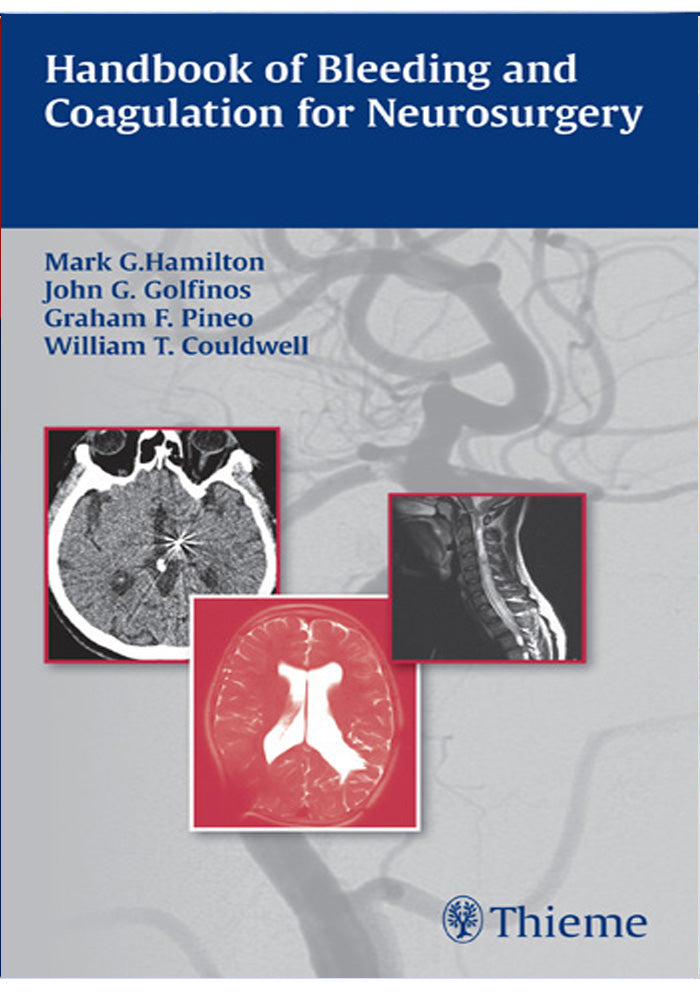 Handbook of Bleeding and Coagulation for Neurosurgery