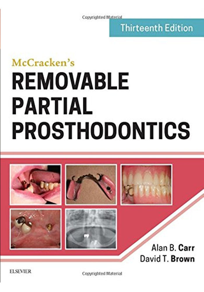 McCracken's Removable Partial Prosthodontics 13th Edition