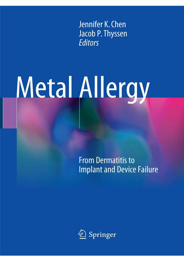 Metal Allergy: From Dermatitis to Implant and Device Failure 1st ed. 2018 Edition