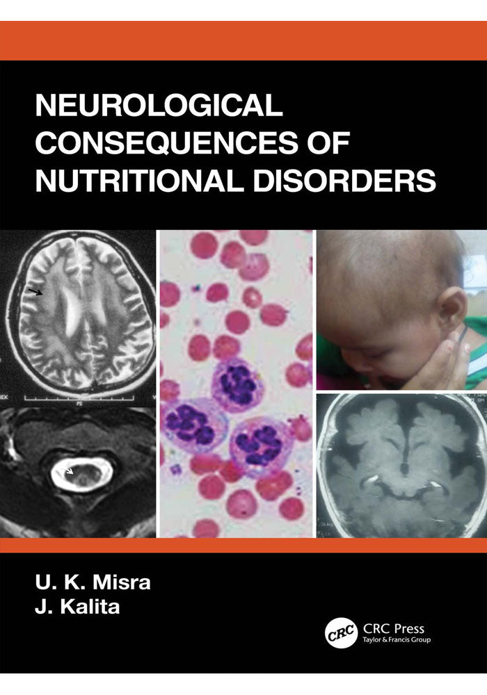 Neurological Consequences of Nutritional Disorders