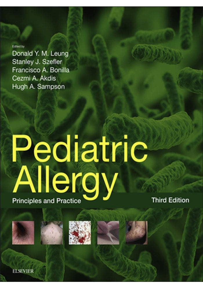 Pediatric Allergy: Principles and Practice E-Book 3rd Edition, Kindle Edition