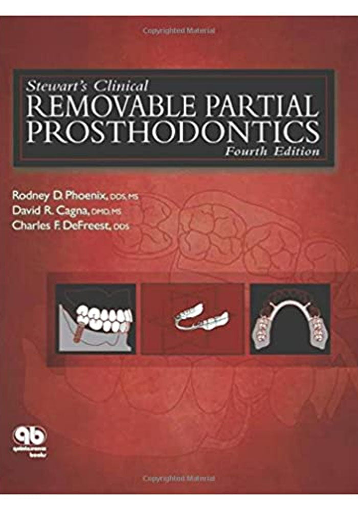 Stewart's Clinical Removable Partial Prosthodontics, 4th Edition 4th Edition