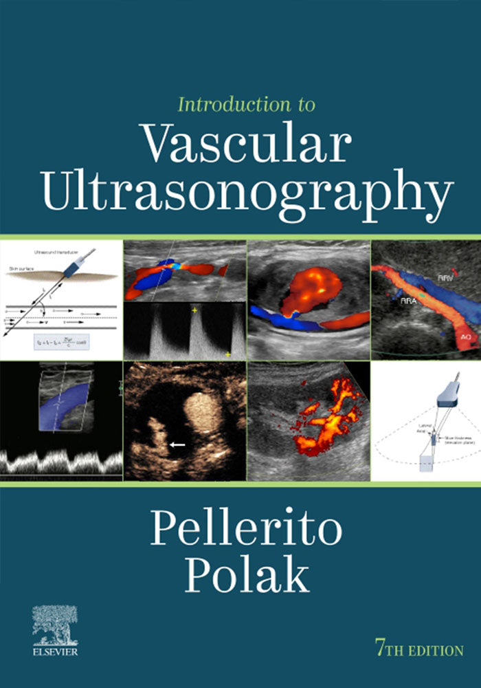 Introduction to Vascular Ultrasonography